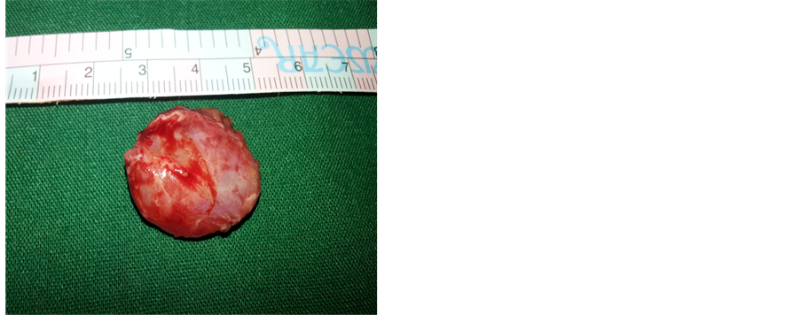 Klestadt s Cyst Case Report klestadt-s-cyst-case-report