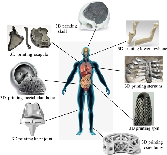 Gennemvæd Konserveringsmiddel kul Application and Development of 3D Printing in Medical Field