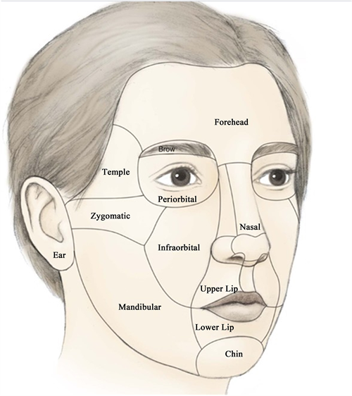 The Use of Rotation Flap to Cover a Facial Defect—A Case Study
