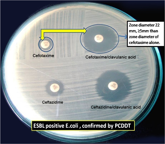 Antibiogram of ExtendedSpectrum βLactamase (ESBL) Producing