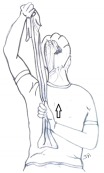 Management of Adhesive Capsulitis of the Shoulder: Recommendation