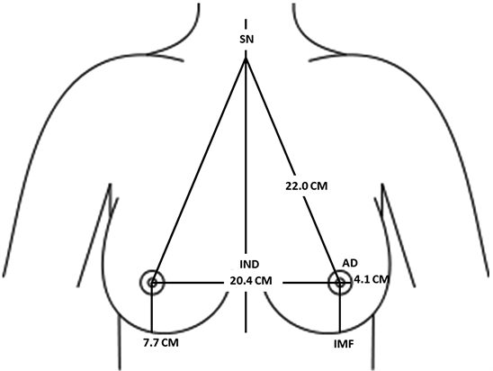 Anthropometric Breast Measurement: Analysis of the Average Breast