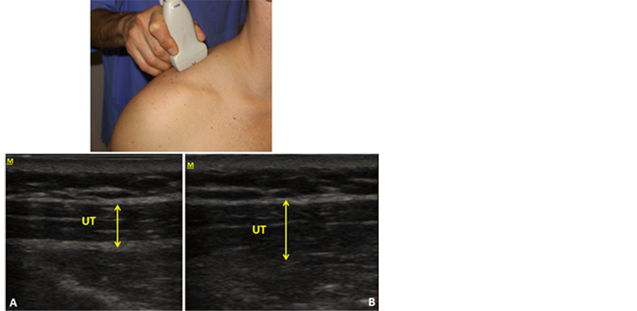 The Use of Ultrasound Images in Manual Therapy and Additionally in
