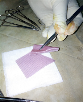 what is the best gun cleaner and lubricant Anal fistula plug versus surgeon's preference for surgery for  trans-sphincteric anal fistula: the FIAT RCT main image 1