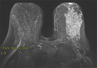 Three Sure-Fire Ways To Burn Fat Get Healthier & Feel Happy Without Dieting