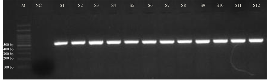 Rapid and Reliable Method of High-Quality RNA Extraction