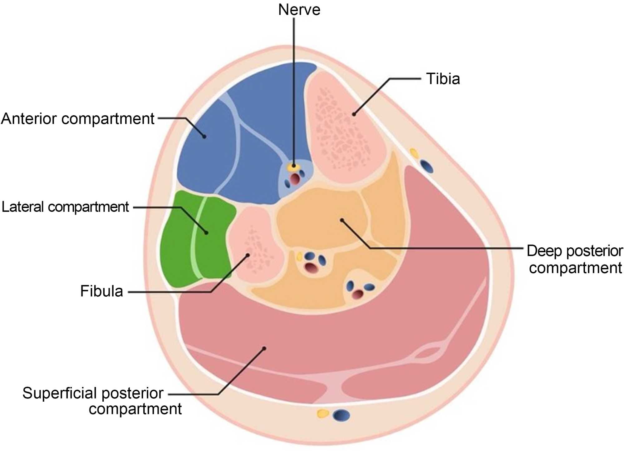 Anterior Tibialis Muscle Herniation in a Pediatric Patient, image size:1999x1444