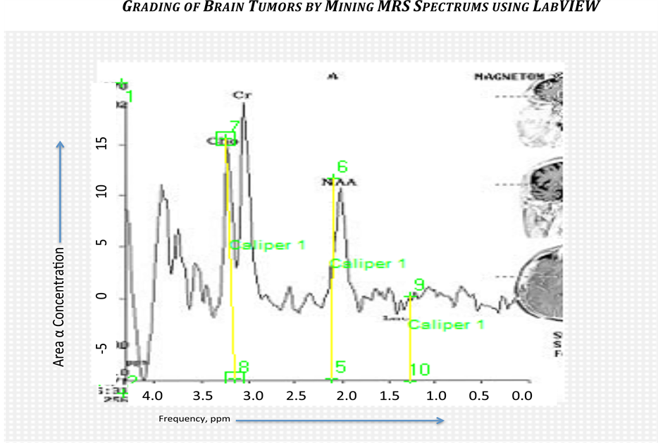 Grading of Brain Tumors by Mining MRS Spectrums Using LabVIEW ...