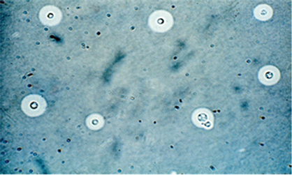 cryptococcus india ink stain