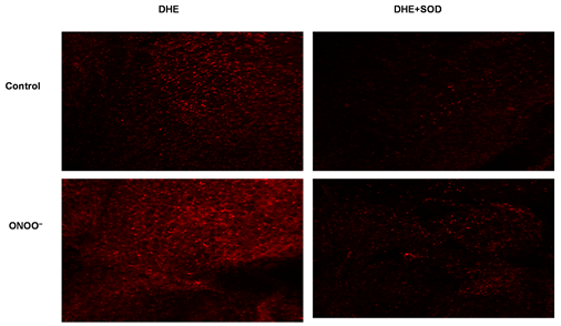 Effect of Peroxynitrite (ONOO-) on the Function of Murine Perivascular  Adipose Tissue