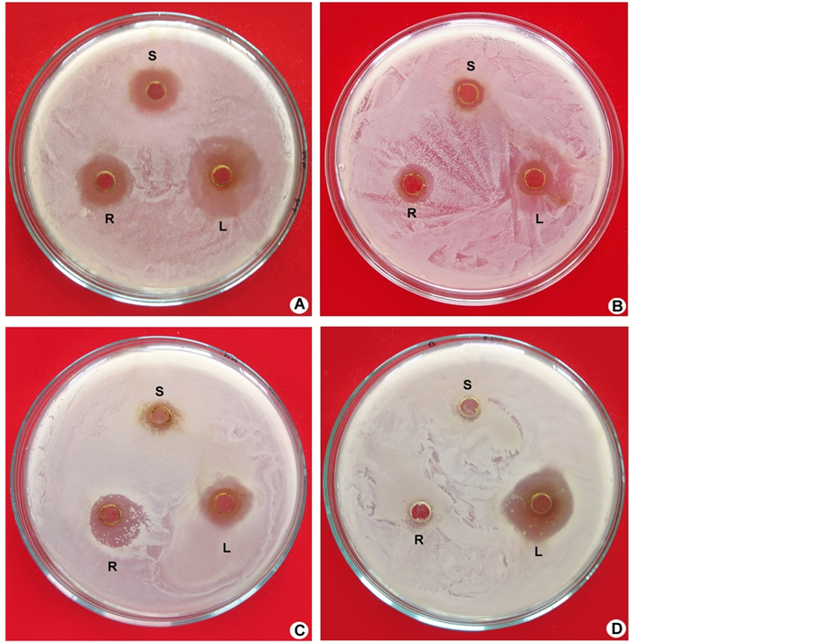 Phytochemical evaluation and in vitro antibacterial activity of
