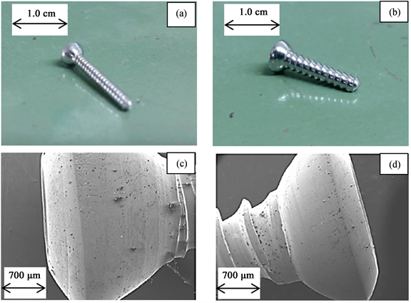 Failure Analysis of Austenitic Stainless Steel Implant