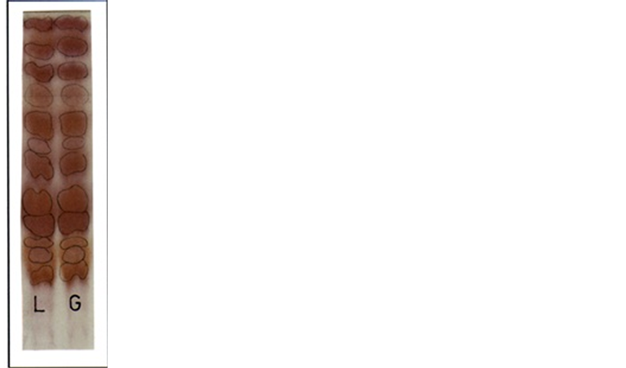 Influence of Seeds and Roots Extracts and Exudates of Bean Plant on