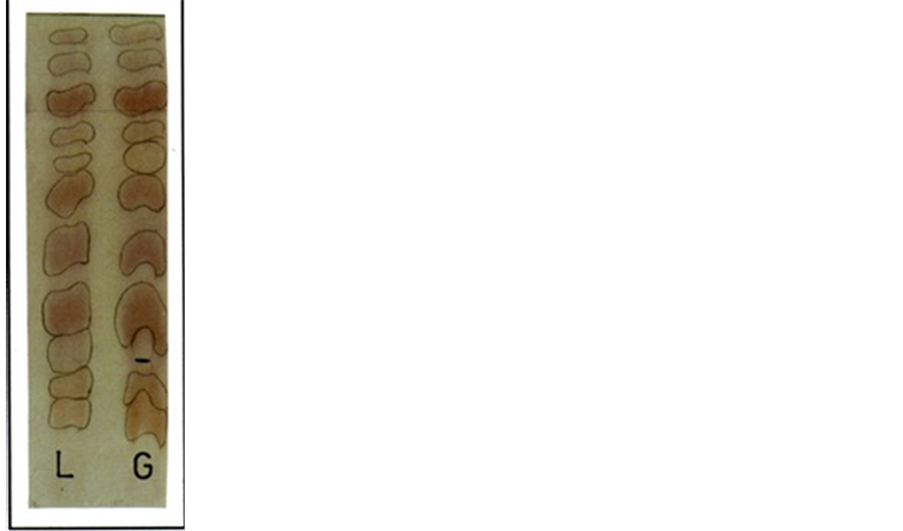 Influence of Seeds and Roots Extracts and Exudates of Bean Plant on