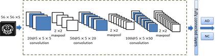 Automatic Alzheimer’s Disease Recognition from MRI Data Using Deep ...